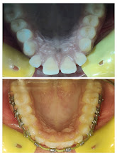 Before & After Transformation 1