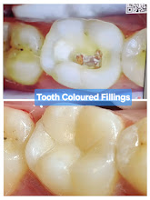 Before & After Transformation 2