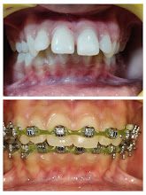 Before & After Transformation 3